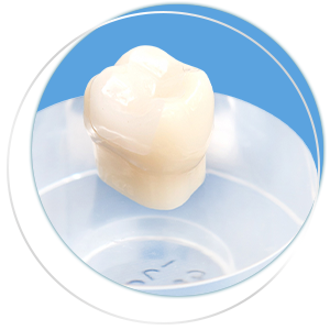 名古屋のかすや歯科インプラント費用・保証