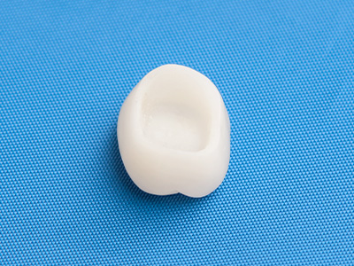 名古屋のインプラント症例4,000以上の実績かすや歯科