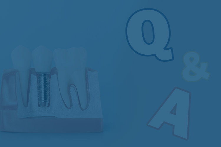 名古屋で実績のあるかすや歯科への質問や不安を解消