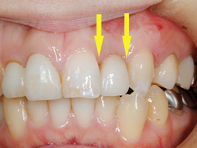 名古屋で実績のある名医による費用を抑えた症例③