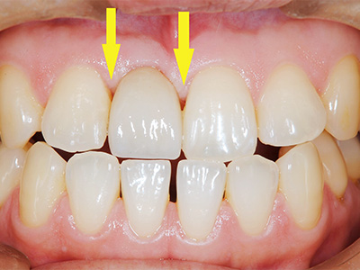名古屋で実績のある名医による費用を抑えた症例④