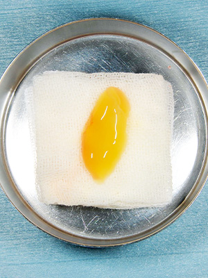 再生医療で難症例でも治療可能