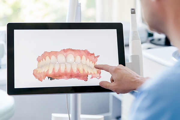 実績があるから安全・安心の精度が実現