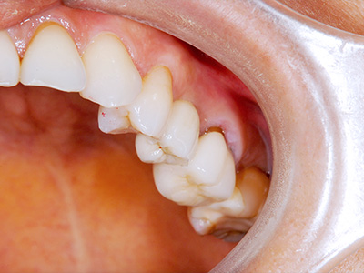 名古屋で実績のある技術で安心して治療を受けられます