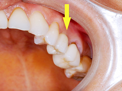 名古屋で実績のある技術で安心して治療を受けられます