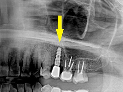 名古屋で実績のある技術で安心して治療を受けられます
