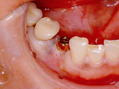 名古屋で実績のある技術で安心できる治療Bofore