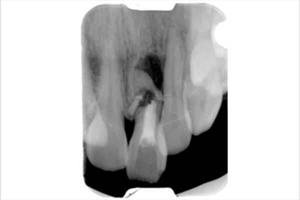 実績のある技術で安心できる治療症例①