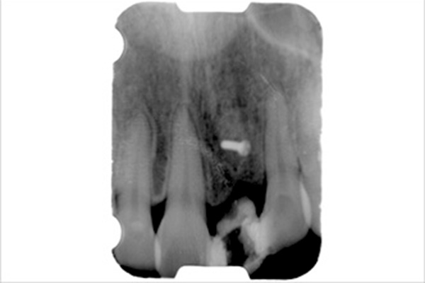 実績のある技術で安心できる治療症例②