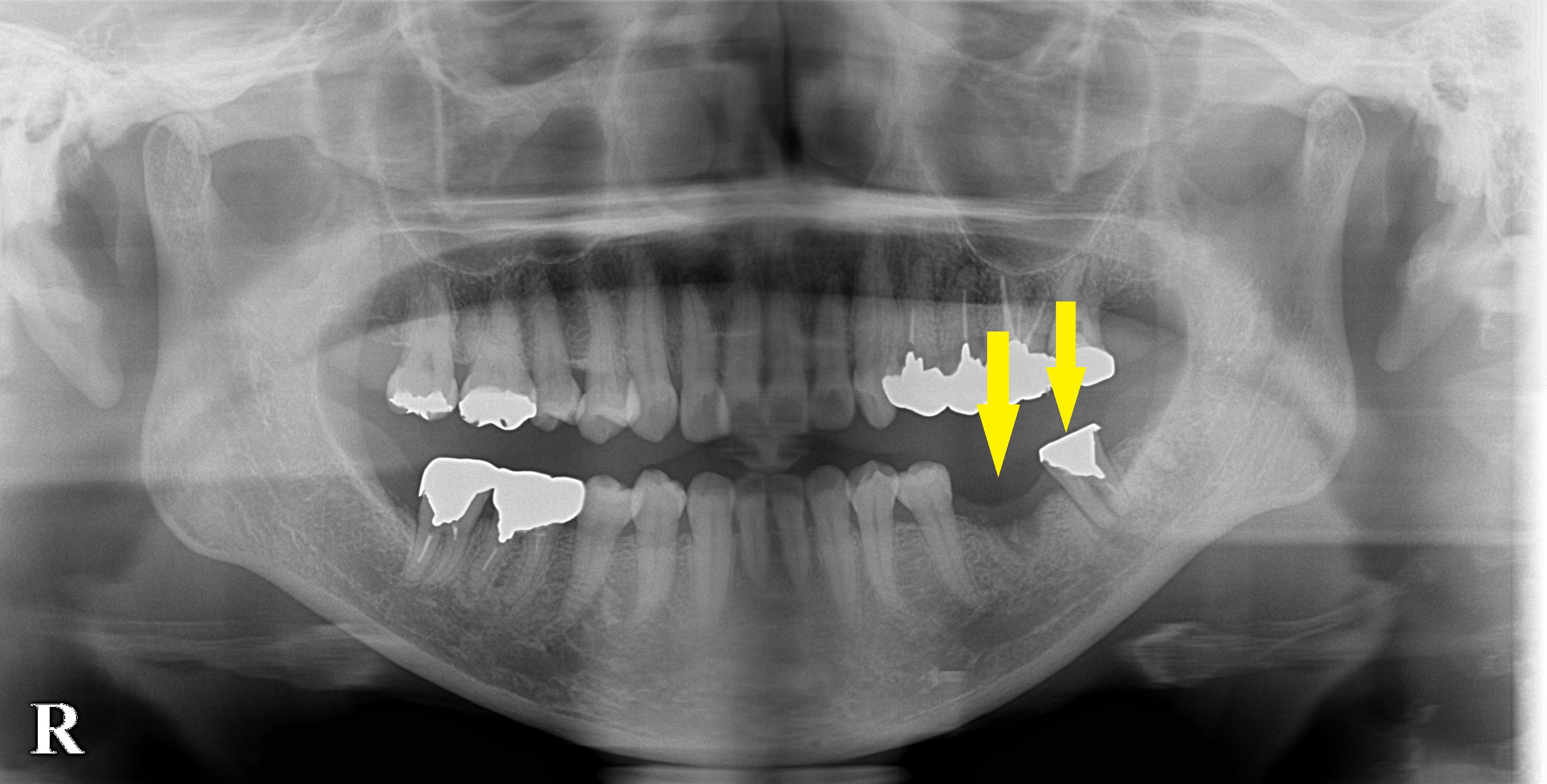 インプラント治療で選ばれる名古屋の歯科医院