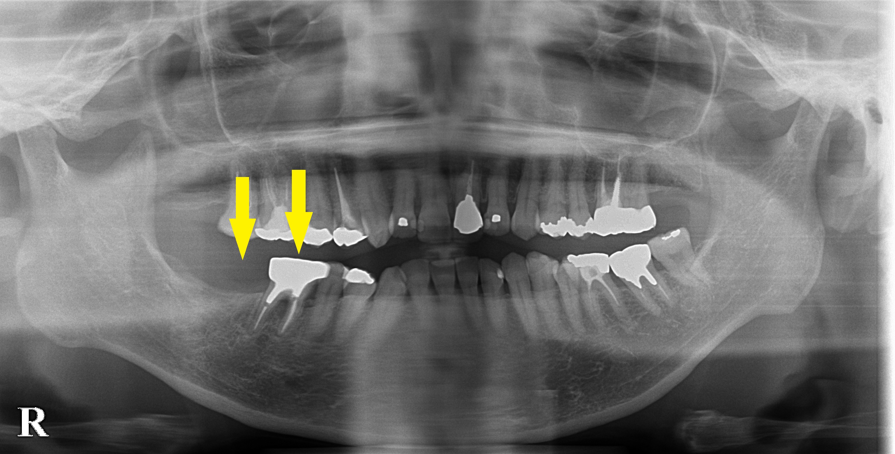 インプラント治療で選ばれる名古屋の歯科医院