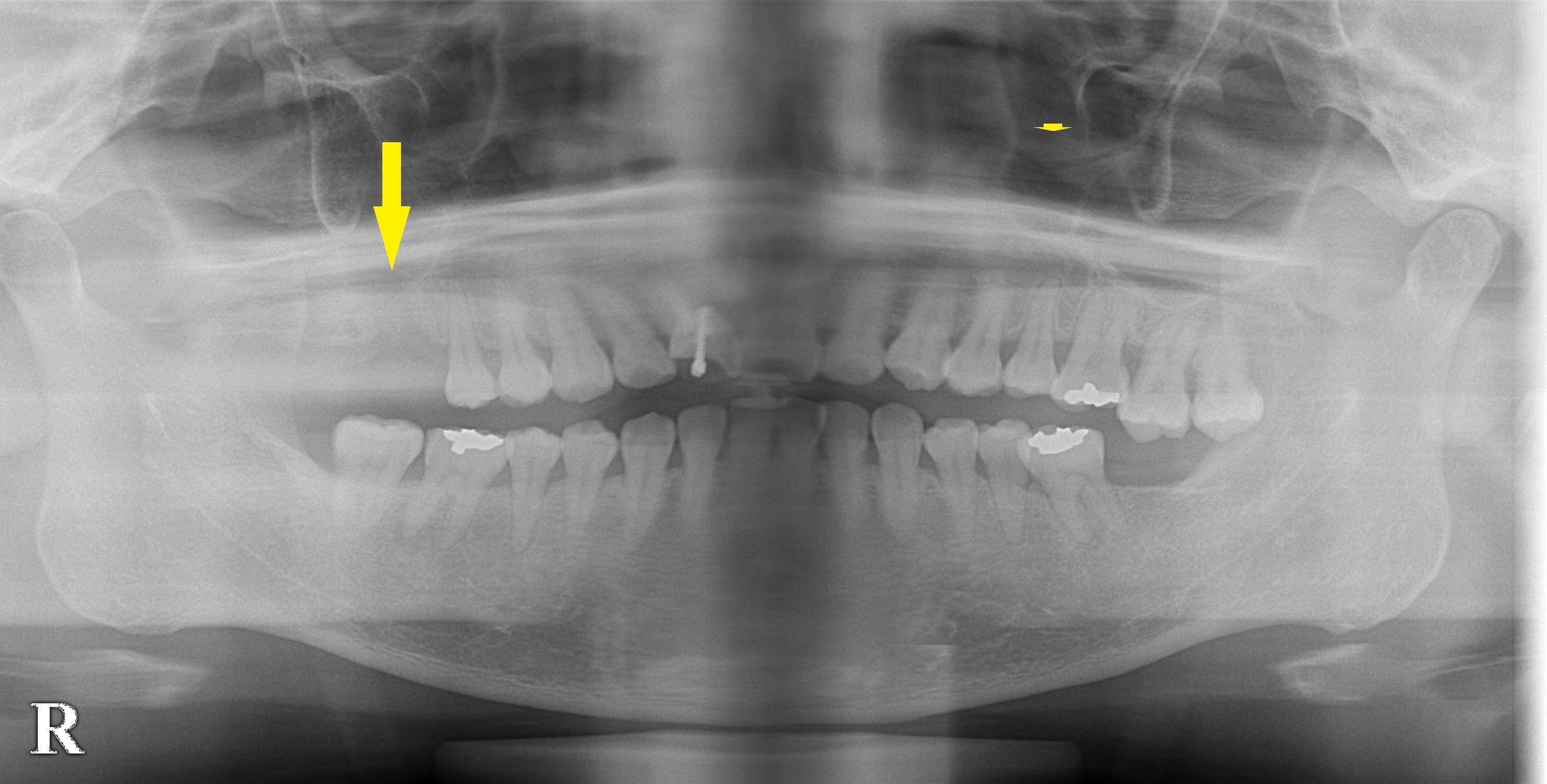インプラント治療で選ばれる名古屋の歯科医院