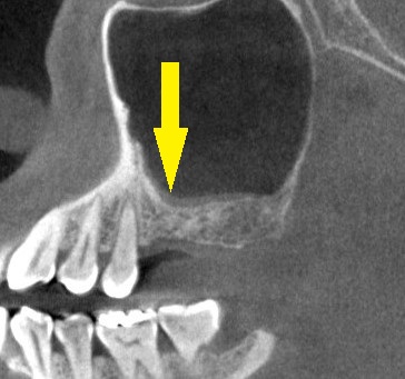 インプラント治療で選ばれる名古屋の歯科医院