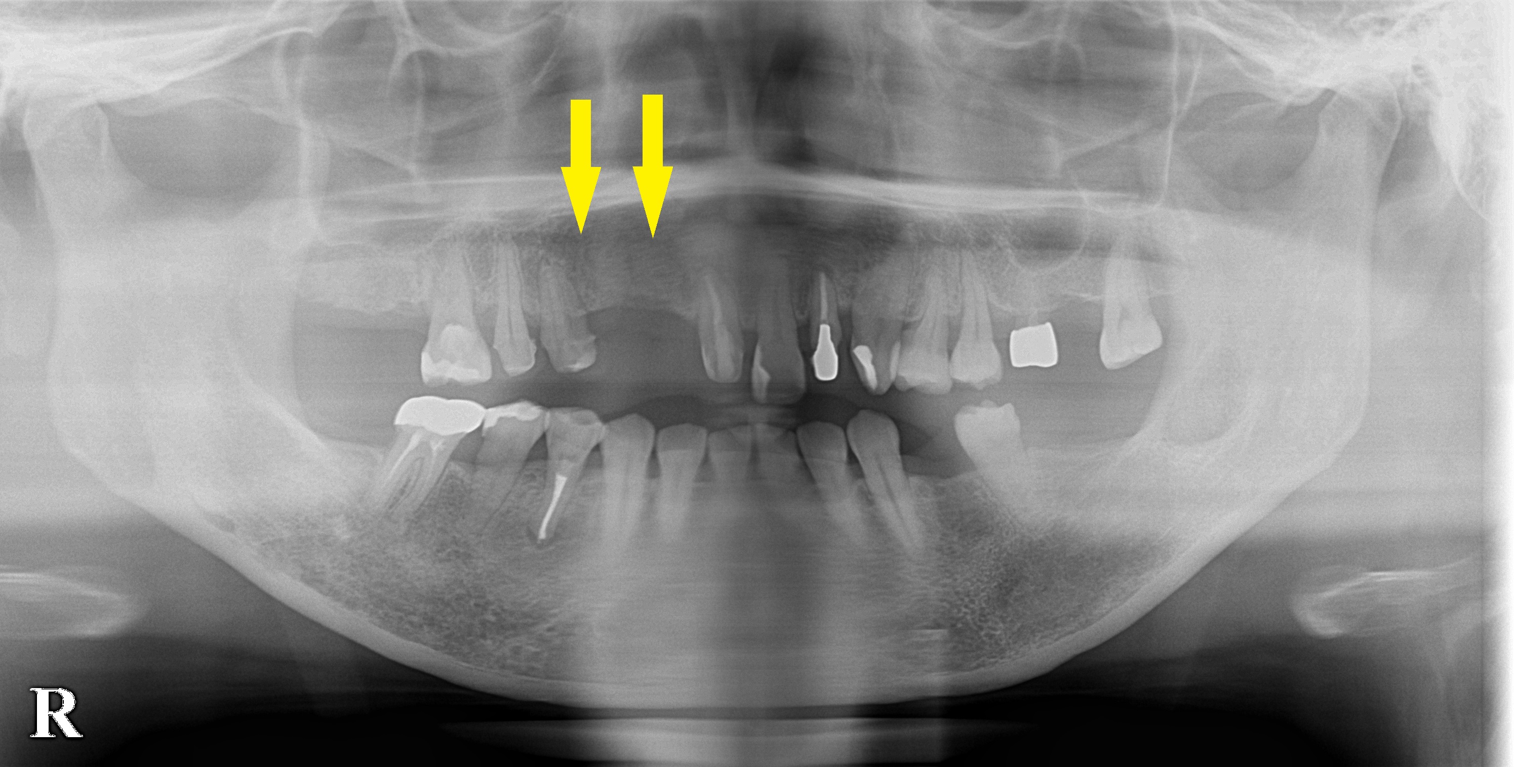 インプラント治療で選ばれる名古屋の歯科医院