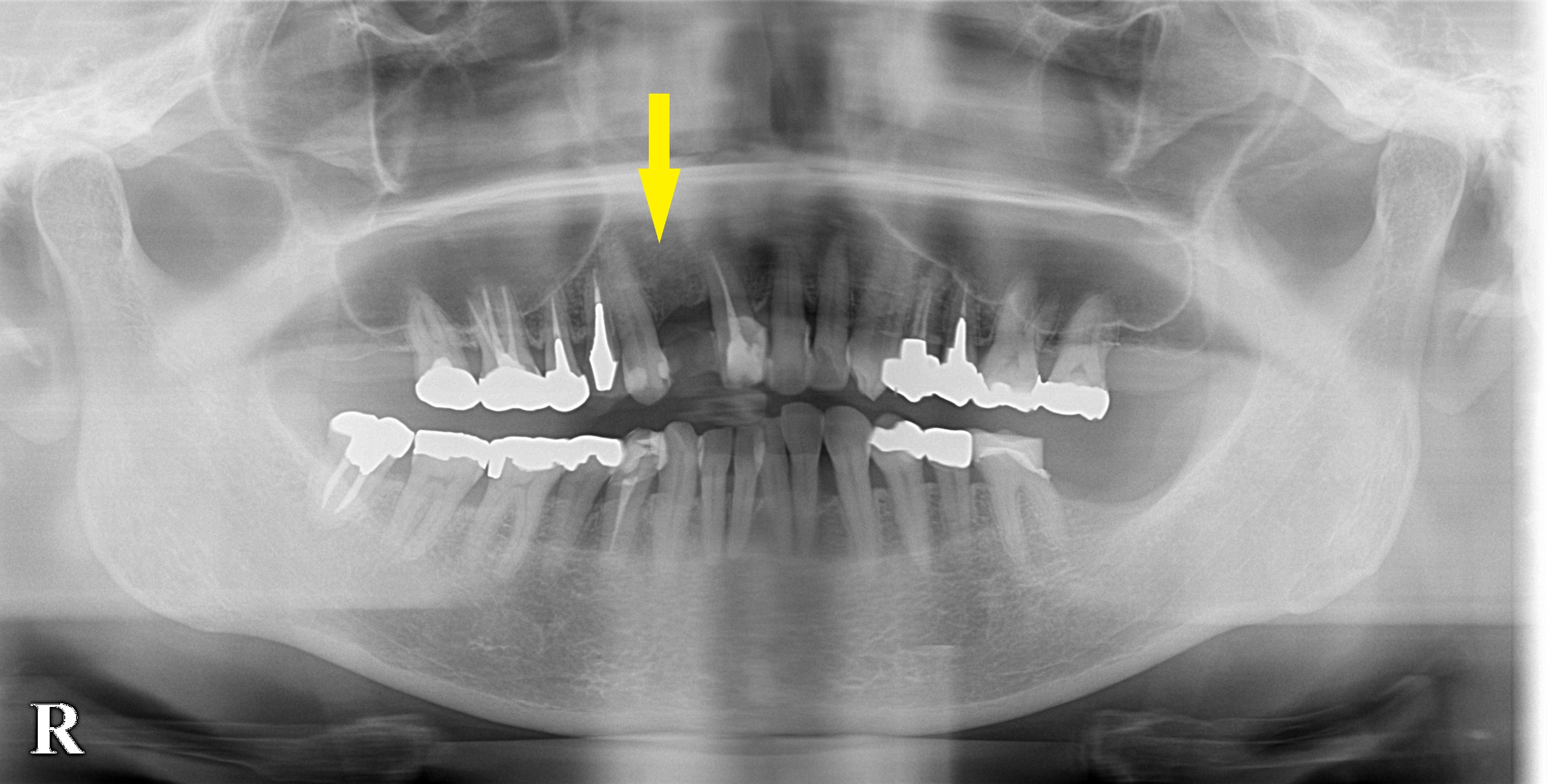 インプラント治療で選ばれる名古屋の歯科医院