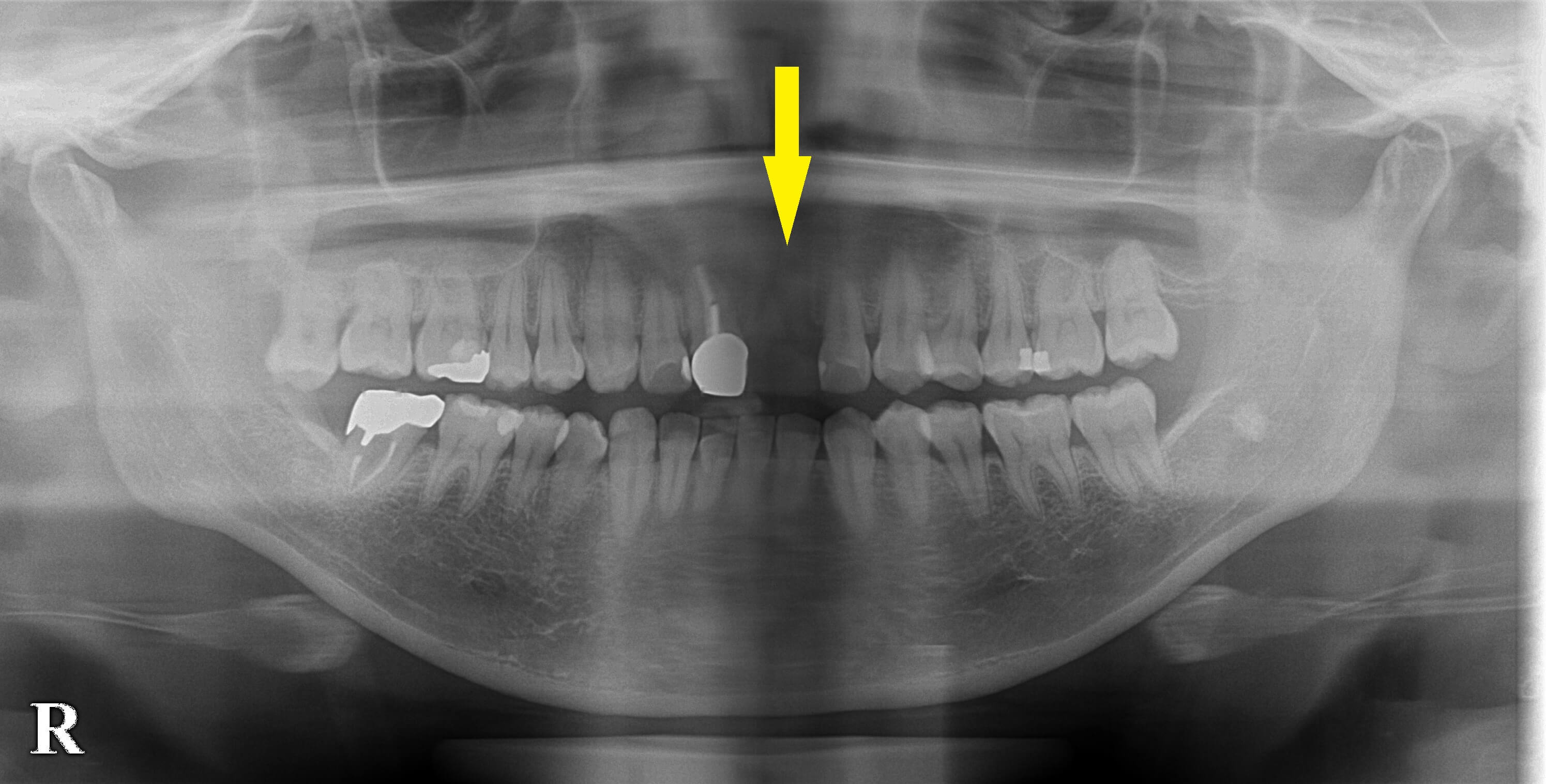 インプラント治療で選ばれる名古屋の歯科医院