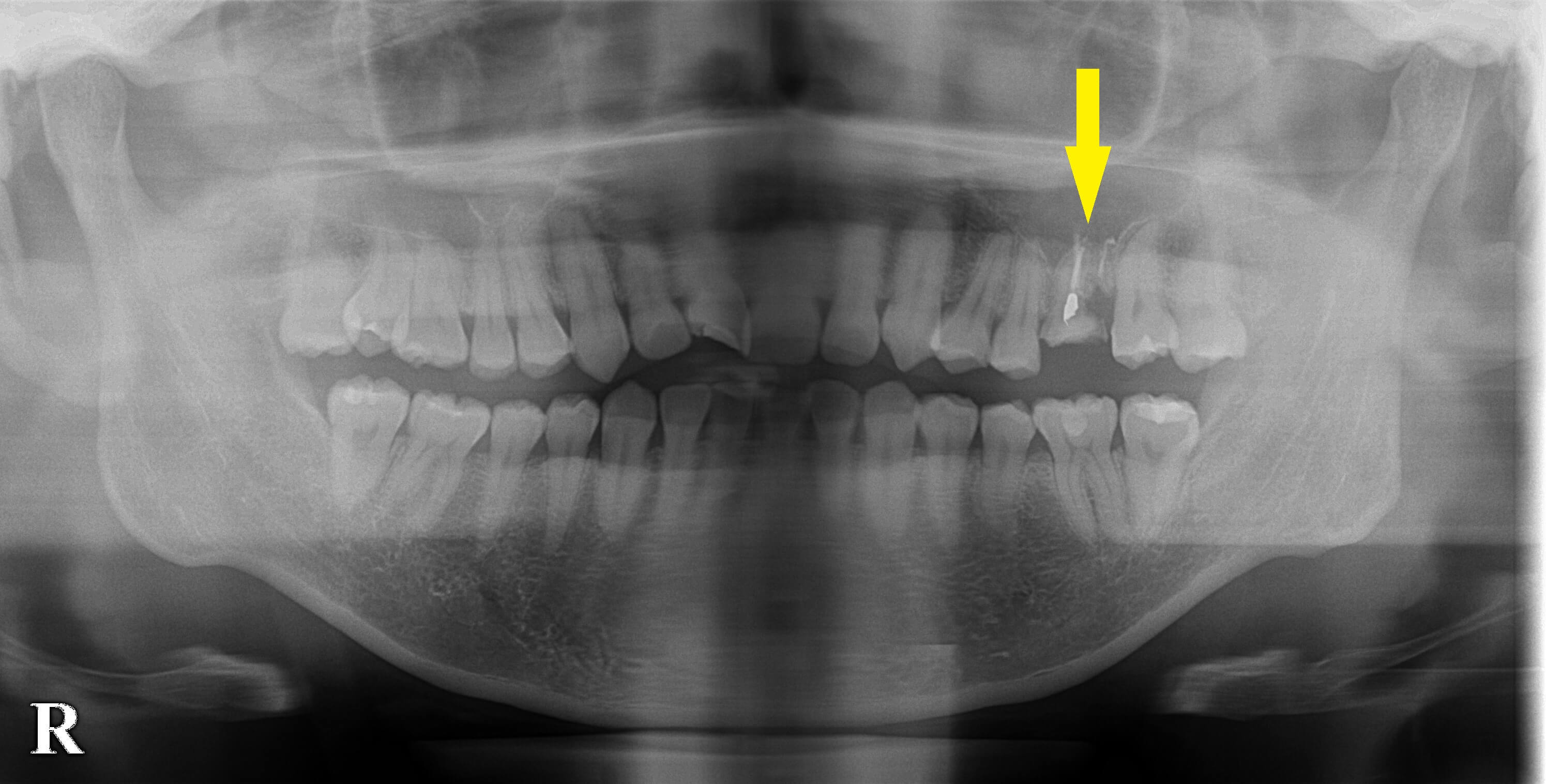 インプラント治療で選ばれる名古屋の歯科医院