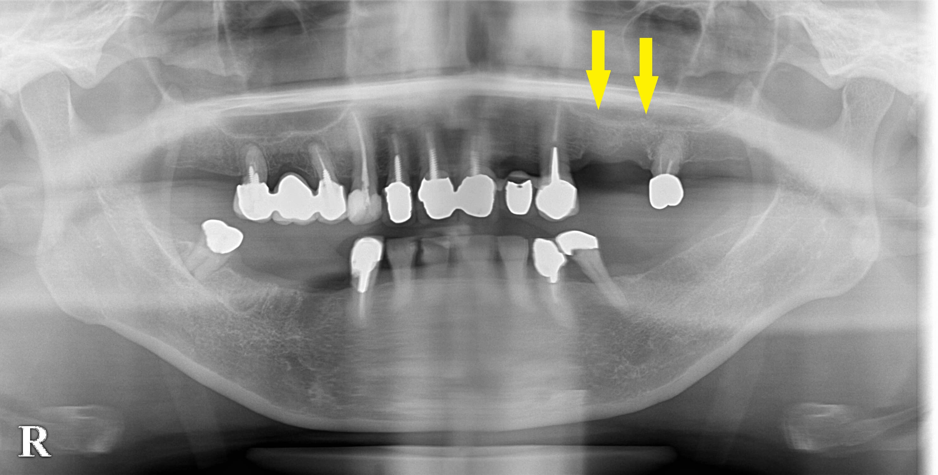 インプラント治療で選ばれる名古屋の歯科医院