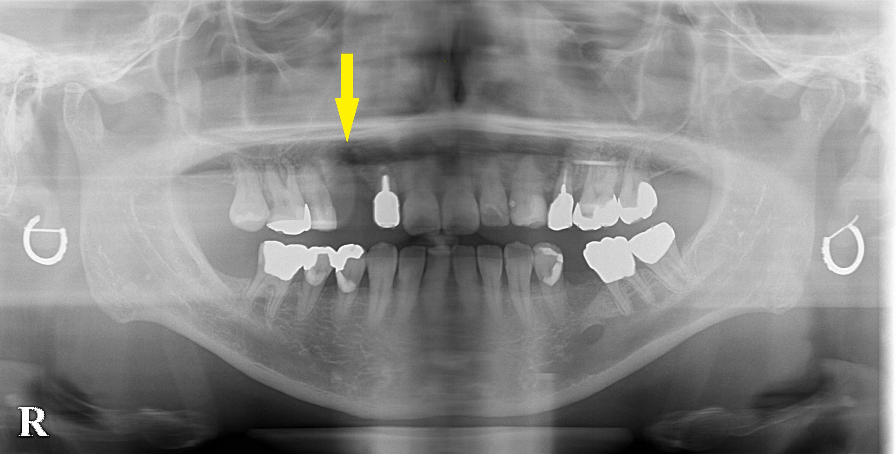 インプラント治療で選ばれる名古屋の歯科医院