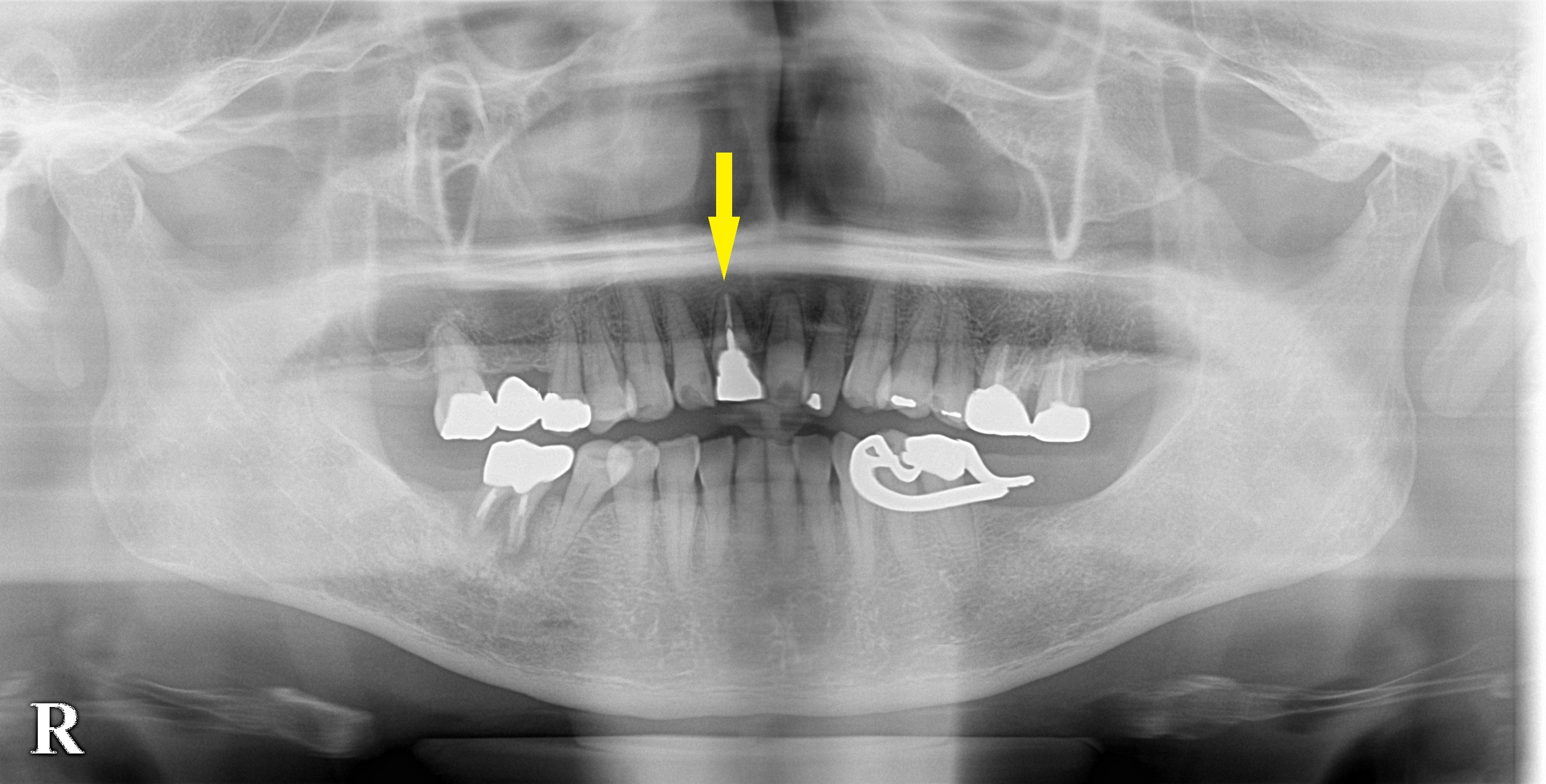 インプラント治療で選ばれる名古屋の歯科医院