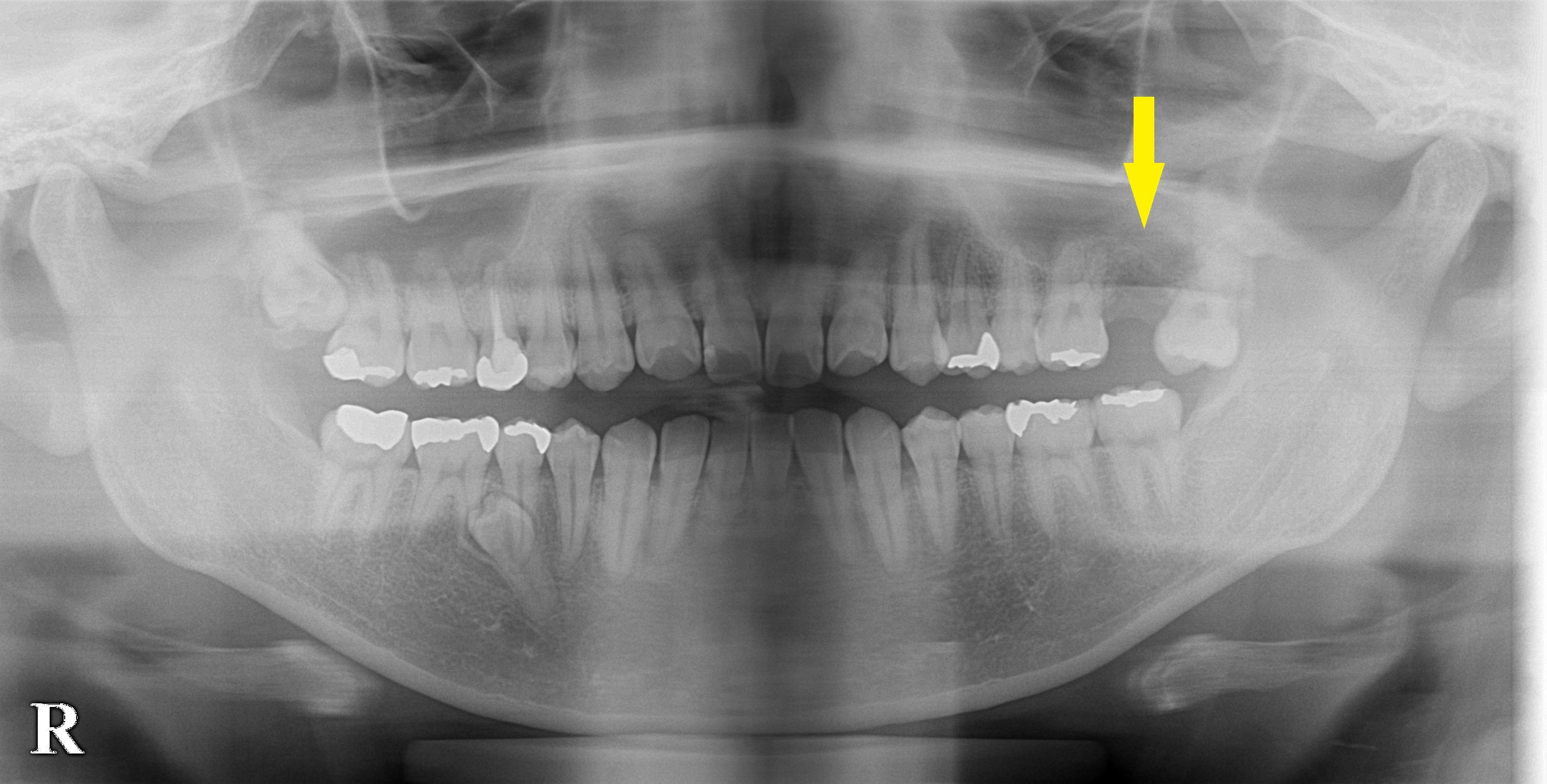 CT画像|インプラント治療で選ばれる名古屋の歯科医院