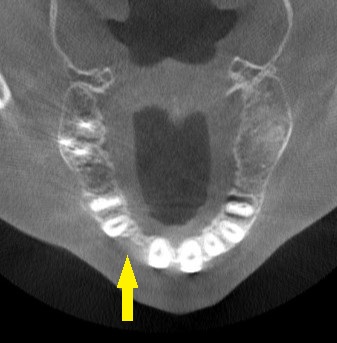 インプラント治療で選ばれる名古屋の歯科医院