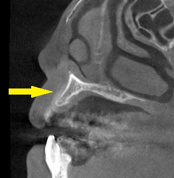 インプラント治療で選ばれる名古屋の歯科医院