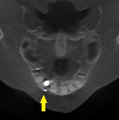 インプラント治療で選ばれる名古屋の歯科医院
