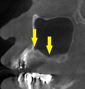 インプラント治療で選ばれる名古屋の歯科医院