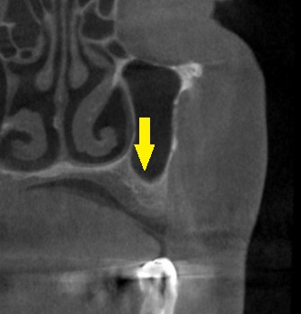 インプラント治療で選ばれる名古屋の歯科医院