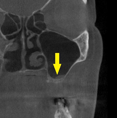 インプラント治療で選ばれる名古屋の歯科医院