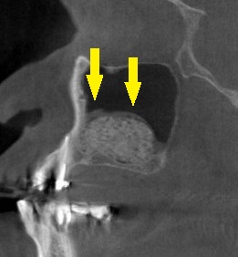 インプラント治療で選ばれる名古屋の歯科医院