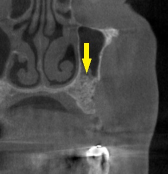 インプラント治療で選ばれる名古屋の歯科医院