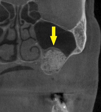 インプラント治療で選ばれる名古屋の歯科医院