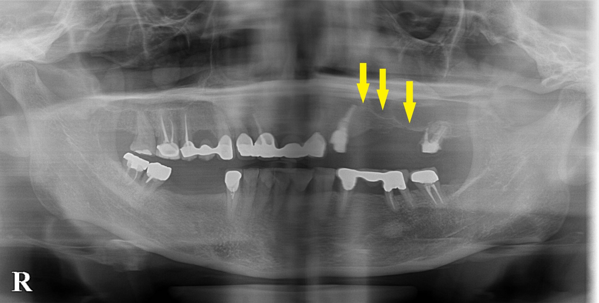 インプラント治療で選ばれる名古屋の歯科医院