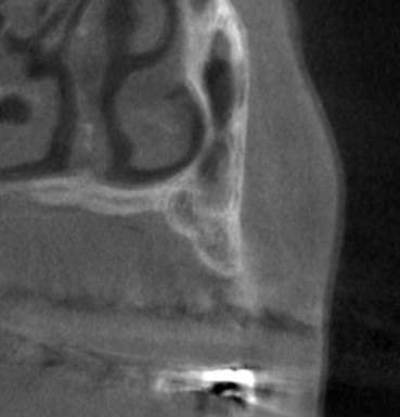 インプラント治療で選ばれる名古屋の歯科医院
