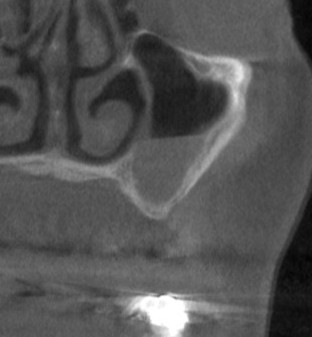 インプラント治療で選ばれる名古屋の歯科医院
