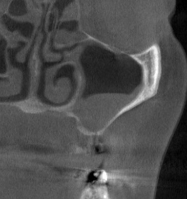 インプラント治療で選ばれる名古屋の歯科医院