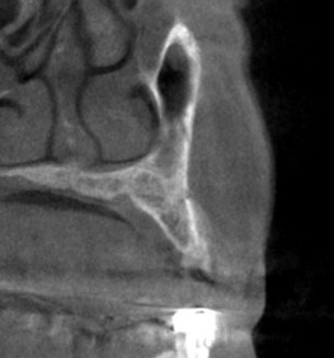 インプラント治療で選ばれる名古屋の歯科医院