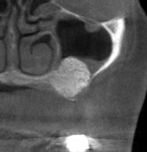 インプラント治療で選ばれる名古屋の歯科医院