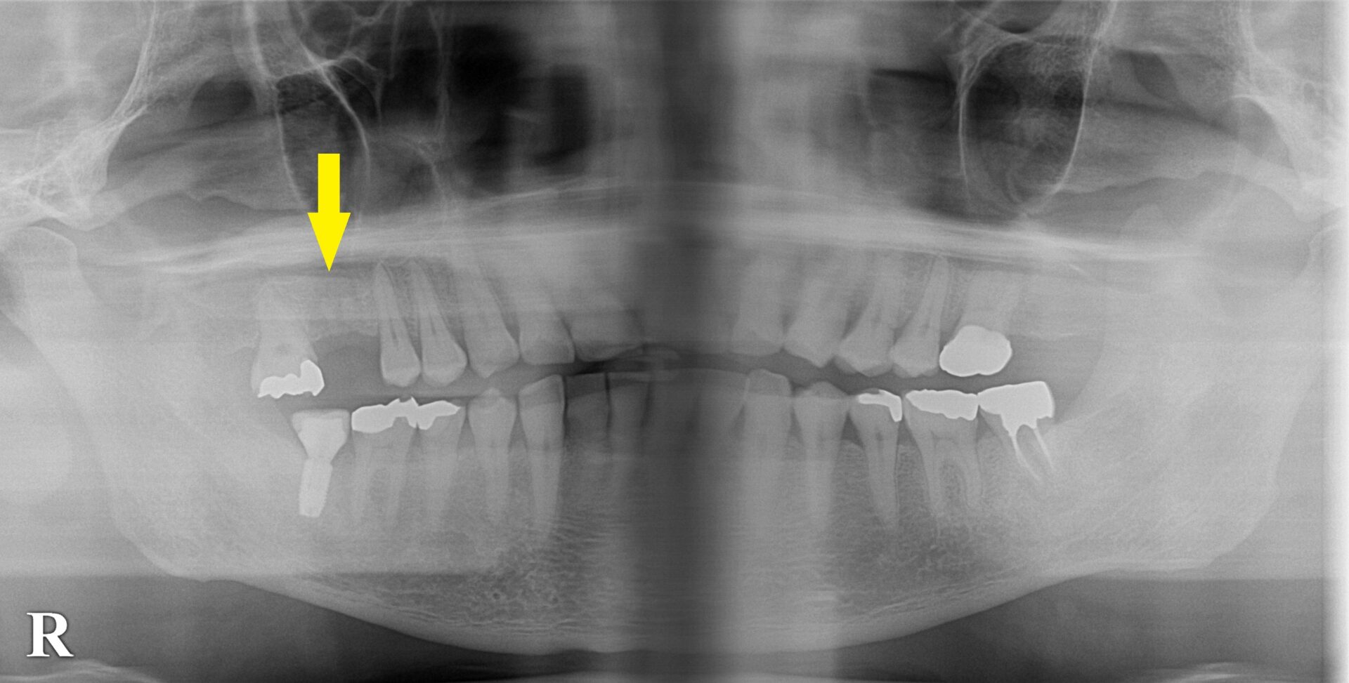 インプラント治療で選ばれる名古屋の歯科医院