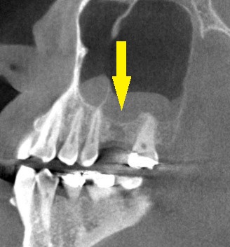 インプラント治療で選ばれる名古屋の歯科医院