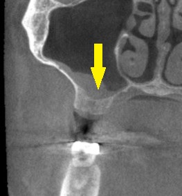 インプラント治療で選ばれる名古屋の歯科医院