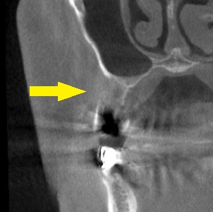 インプラント治療で選ばれる名古屋の歯科医院