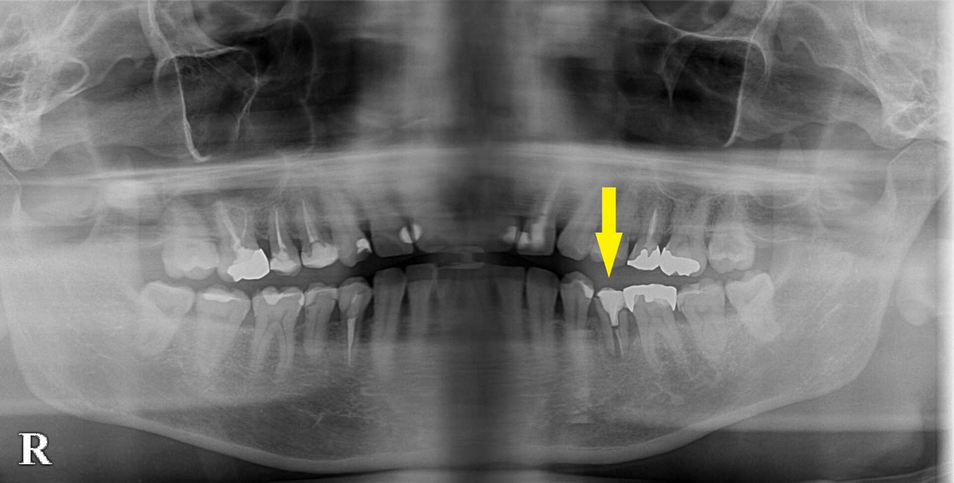 インプラント治療で選ばれる名古屋の歯科医院
