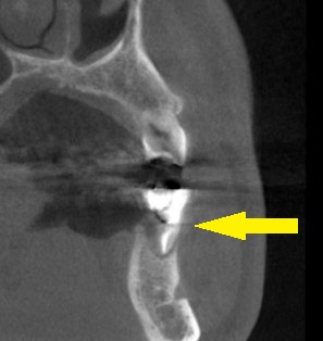 インプラント治療で選ばれる名古屋の歯科医院
