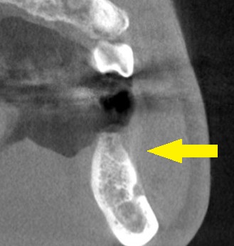 インプラント治療で選ばれる名古屋の歯科医院