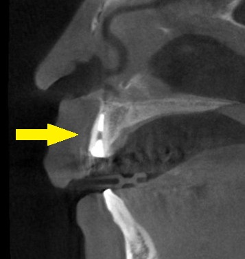 インプラント治療で選ばれる名古屋の歯科医院