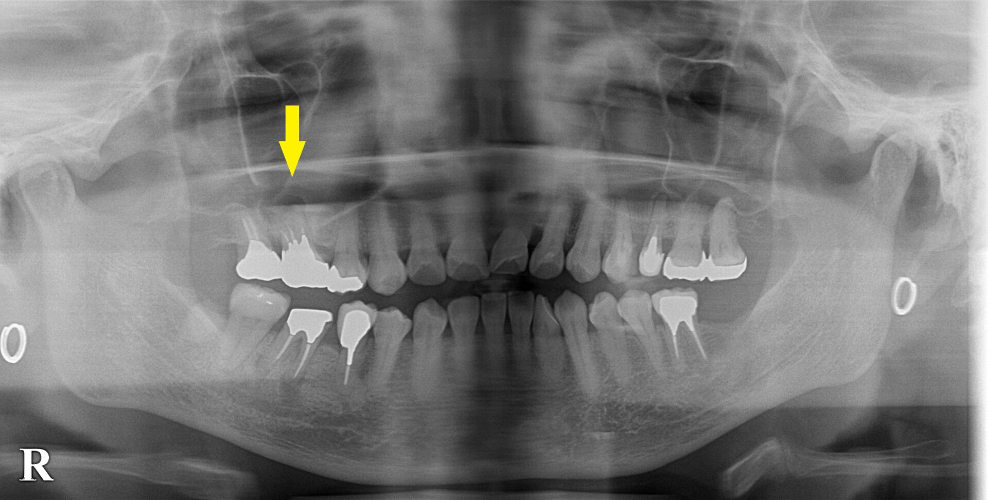 インプラント治療で選ばれる名古屋の歯科医院