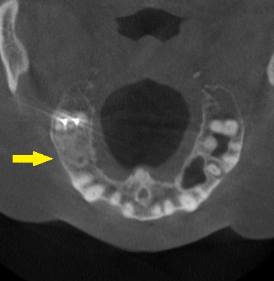 インプラント治療で選ばれる名古屋の歯科医院